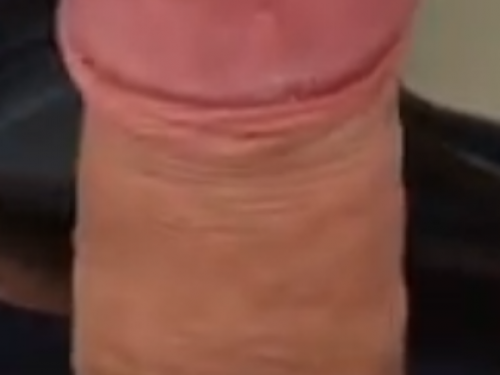 lTUYl
